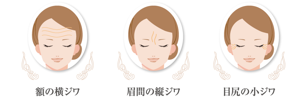 額の横ジワ、眉間の縦ジワ、目尻の小ジワ